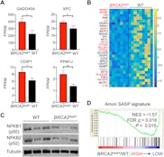 Aneuploidy and a deregulated DNA damage response suggest haploinsufficiency in breast tissues of BRCA2 mutation carriers.